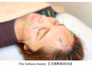ザ ベルネス(The bellness)/【美容鍼】