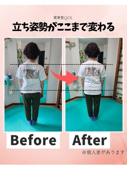 健康塾キューオーエル 恵比寿(QOL)の写真/【驚きのリフレッシュ体験】後ろ姿に自信！体の歪みを整えて、すっきりまっすぐ整う感動の立ち姿へ！！