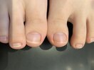 【フットネイルケア】