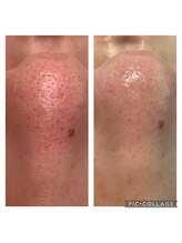 アトリエ ホミィ/