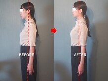 アトラス/初回のお客様のBefore＆after