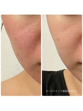 エクラ(eclat)/クリスティーナ