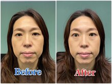 お顔悩み&小顔リフトアップを最短で改善へと導きます！