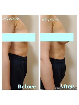 ラプレーヌ(La pleine)/