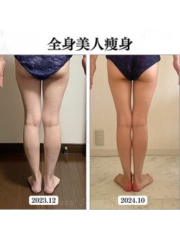 リルチェ 自由が丘(RILUCE)/全身美人痩身効果写真
