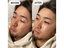 ビトタン 倉敷本店(+美to鍛)/シュッと眉！すべすべお肌に