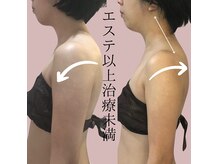 ドマーニ(Domani)の雰囲気（オールハンドテクニックリヴァイセルボディ身体の軽さに感動！）