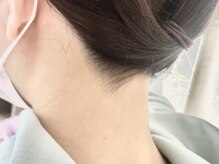 ◆光脱毛（国産機種）◆フェイシャルWAX脱毛（CIBTAC)Wax xxx