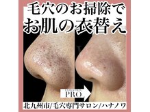 ハナノワ(花のWA)の雰囲気（今まで何をしても改善しなかった毛穴汚れ。当店にお任せ下さい！）