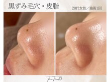 スリースリー(THREE THREE)/毛穴黒ずみ・詰まりケア