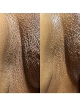 スリール(sourire)/話題のフェムケア