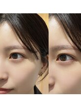 コア(koa)/美眉ワックス/まつげパーマ