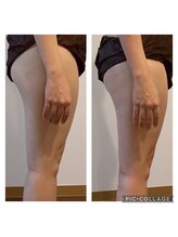 アトリエ ホミィ/