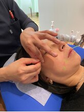 三和旭が丘院/美容鍼☆【眼精疲労/疲れ/日野】