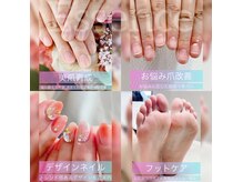 エッセンス (Essence)