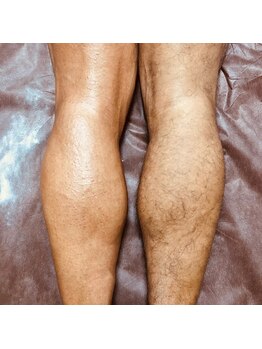 ハレノヒ(HaLeNoHi)/【ブラジリアンワックス】