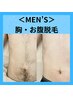 【メンズ脱毛】　胸+お腹脱毛 ￥2,200