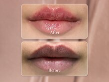 ビューティ サロン ココ ア ドール(Coco a Doll)/LEMELLA‐ルメラ‐