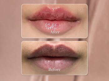 ビューティ サロン ココ ア ドール(Coco a Doll)/LEMELLA‐ルメラ‐