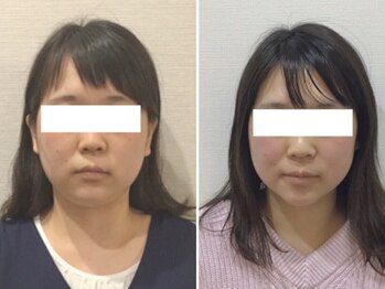 ウェリナ 一宮院/小顔矯正/骨盤矯正/痩身整体