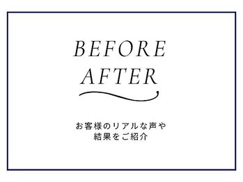 ニキビケア研究所 横浜店/BEFORE AFTER