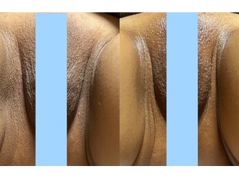 スリール(sourire)/話題のフェムケア