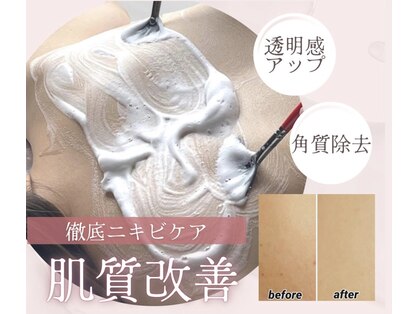 マニッシュ(Mannish)の写真