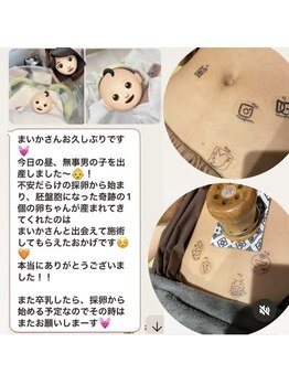 舞香鍼灸治療院/【奇跡の妊娠】ご報告☆