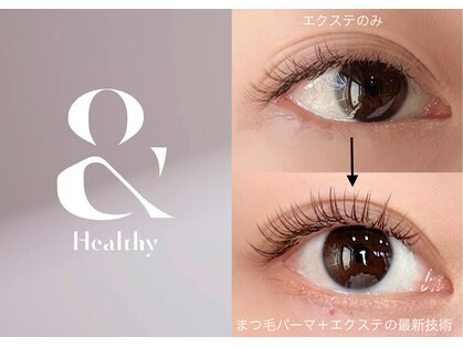 ロイル コア ビューティー(Loeyle core beauty)の写真