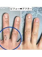 桃の木 吉祥寺店/水分ケアで手荒れ知らず