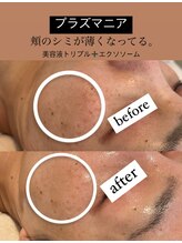 ビューティーネイル(Beauty Nail)/プラズマニア