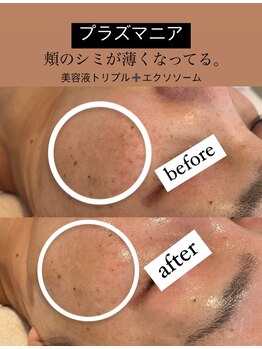 ビューティーネイル(Beauty Nail)/プラズマニア