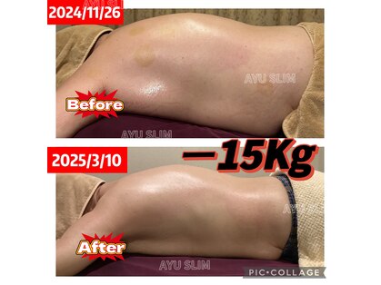 アユスリム(AYU SLIM)の写真