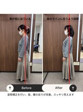 ルピナス整体院/姿勢矯正のビフォーアフター