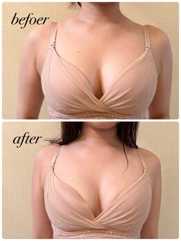 シャルマン(Charmant)/befoer、after