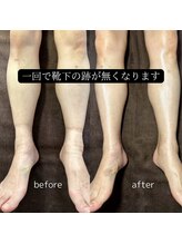 ジョイ 茅ヶ崎北口店(JOY)/before　after