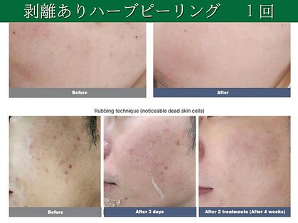 アンナビューティ 六本木 乃木坂店(Anna Beauty)の写真