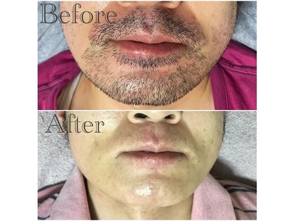 トータルメンズエステ キング(KING)の写真