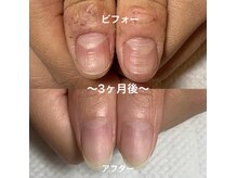 手荒れ、ささくれも改善◎自爪育成ケアで眺めたくなる爪に！