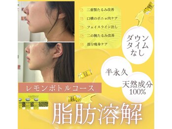 ルミナエステ(LUMINA ESTH)