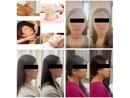 セルビューティー(Cell Beauty)の写真