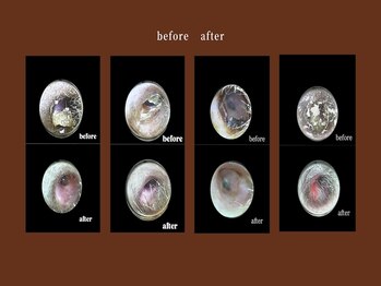 お耳天国 名古屋栄店/整えの刻　前後