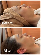 クレール(clair)/「セルマン・メソッド」前後写真