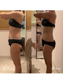 ケイカ 下北沢(KEIKA)/ブライダルビフォーアフター