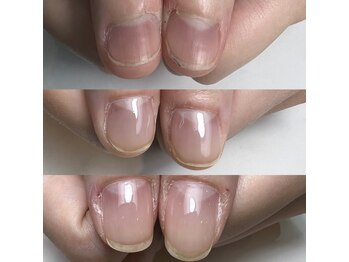 ロイヤル ネイルサロン(Royal nail Saloon)/自爪が変わる自爪育成