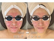 ギンレイ(GINREI)/ 【Before → After】