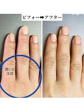 桃の木 吉祥寺店/指先が綺麗だと気持ちにも余裕