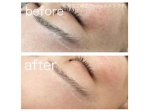 ラクシー 北千住(luxssy)/顔シェービング