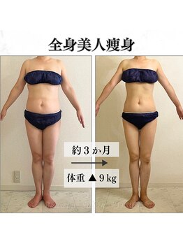 リルチェ 自由が丘(RILUCE)/全身美人痩身効果写真