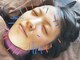 やまざき鍼灸整骨院の写真/美容鍼とヒト幹細胞液のW効果でお悩みも解決◎小顔・ほうれい線・シミ改善・たるみケアに